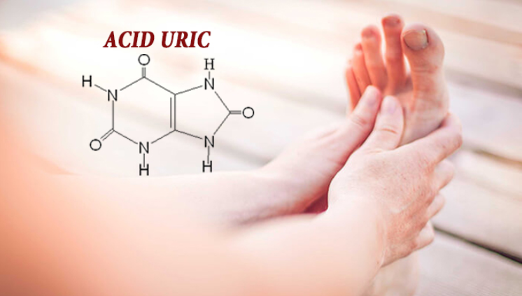 Xét nghiệm acid uric tăng liệu có phải mắc bệnh gout? - Ảnh 2.