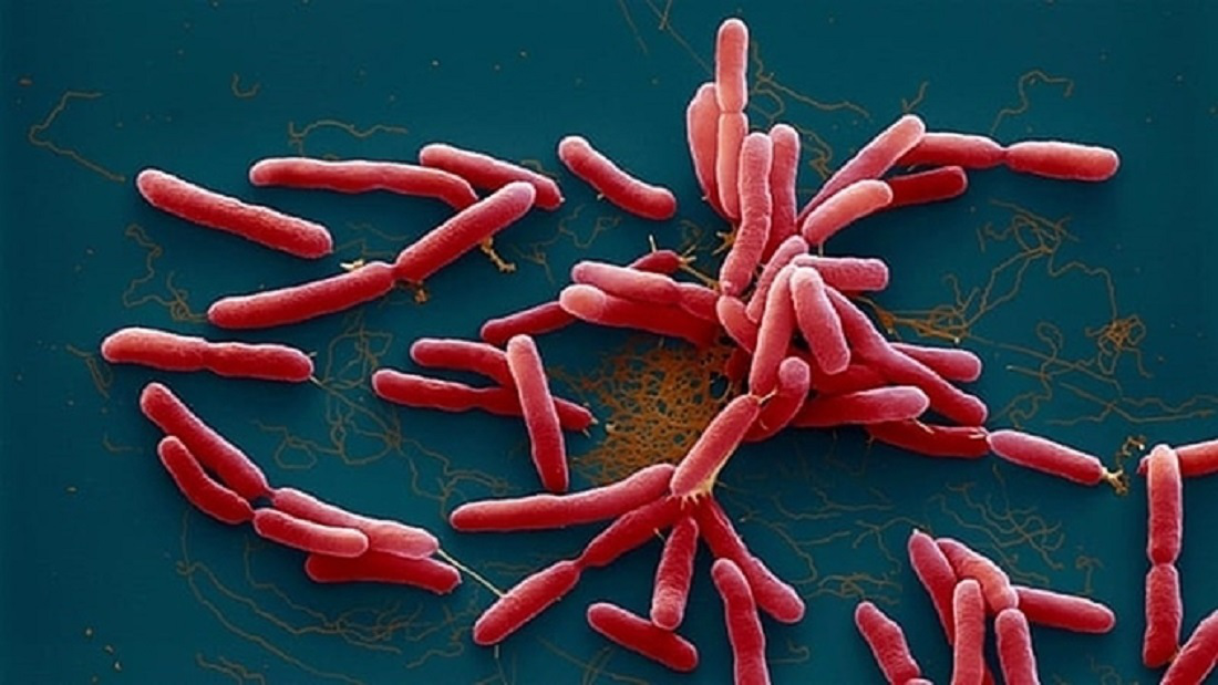 Cảnh giác với bệnh nhiễm trùng, nhiễm độc do vi khuẩn "ăn thịt người" - Ảnh 3.