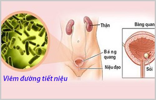 Đường tiết niệu của phụ nữ cũng được cấu tạo khác với nam giới, điều này cũng giải thích tại sao nhiễm trùng tiểu phổ biến hơn ở phụ nữ.