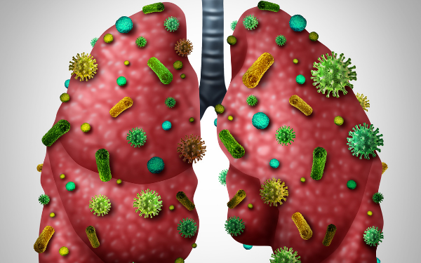 Viêm phổi không điển hình do vi khuẩn ở trẻ