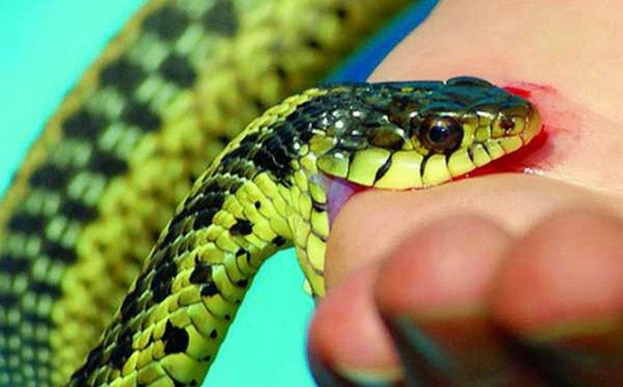 Sơ cứu ban đầu khi bị rắn cắn và cách nhận biết rắn độc, rắn không độc - Ảnh 5.