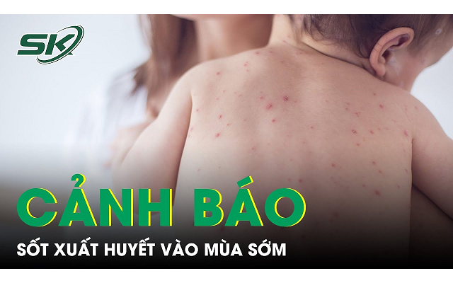 Cảnh báo sốt xuất huyết vào mùa sớm