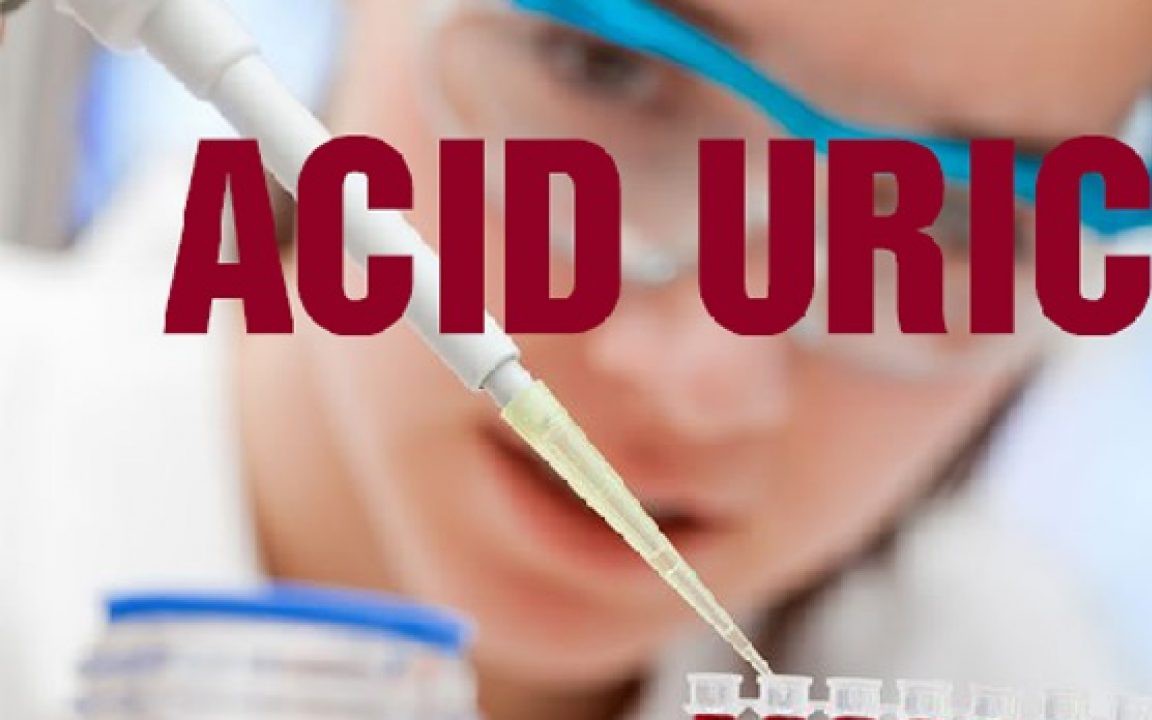 Acid uric là gì, acid uric trong máu cao có nguy hiểm?