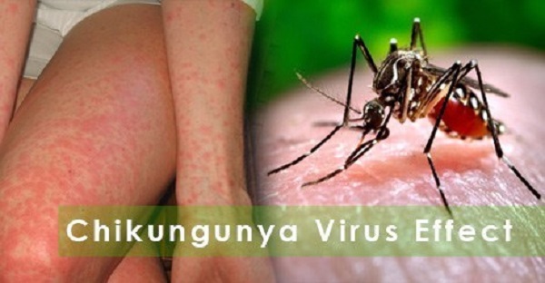 Sốt xuất huyết Dengue và bệnh Chikungunya cùng do muỗi đốt có biểu hiện như nào? - Ảnh 3.