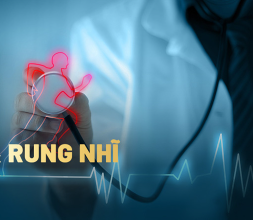 Rung nhĩ làm tăng nguy cơ đột quỵ, dấu hiệu phát hiện sớm cơn đột quỵ - Ảnh 1.