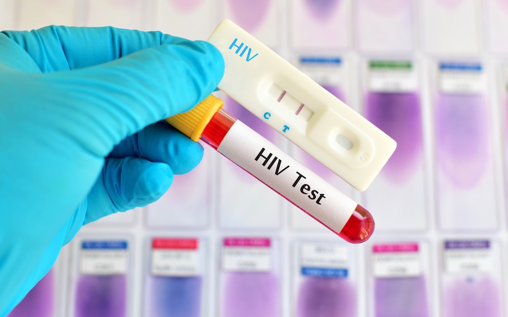 WHO hướng dẫn mới về ức chế HIV và lồng ghép HIV vào chăm sóc sức khỏe ban đầu