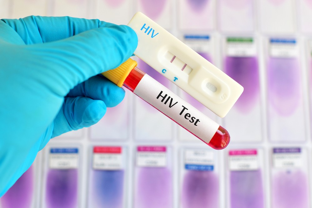 WHO hướng dẫn mới về ức chế HIV và lồng ghép HIV vào chăm sóc sức khỏe ban đầu - Ảnh 3.