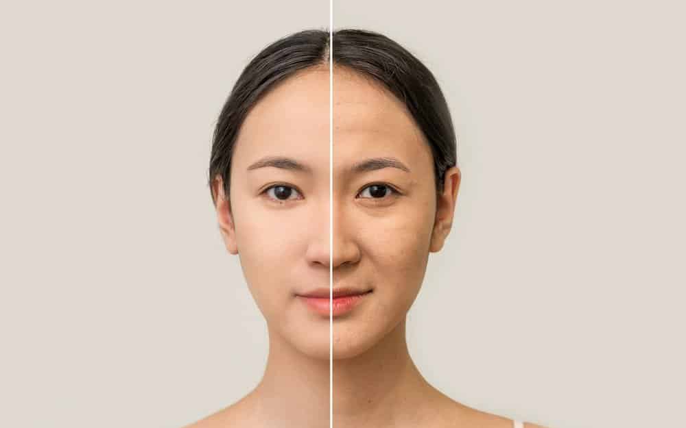 Nguyên nhân gây lão hóa da sớm và cách ngăn chặn