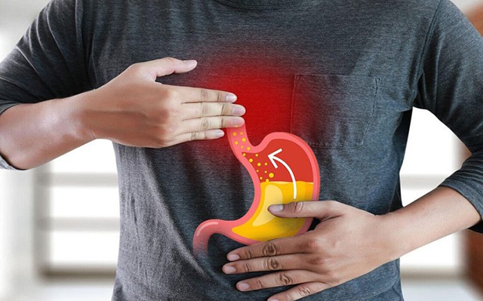 Nội soi dạ dày những điều cần biết