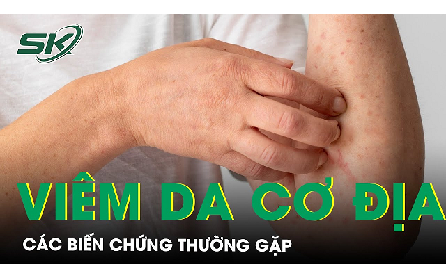 Biến chứng của viêm da cơ địa