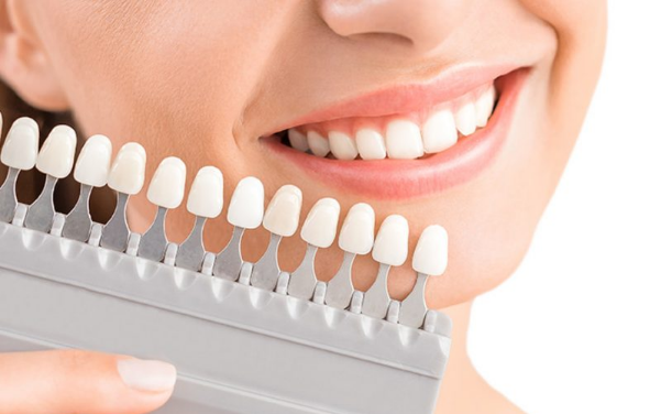 Hiểm họa khôn lường khi bọc răng sứ giá rẻ