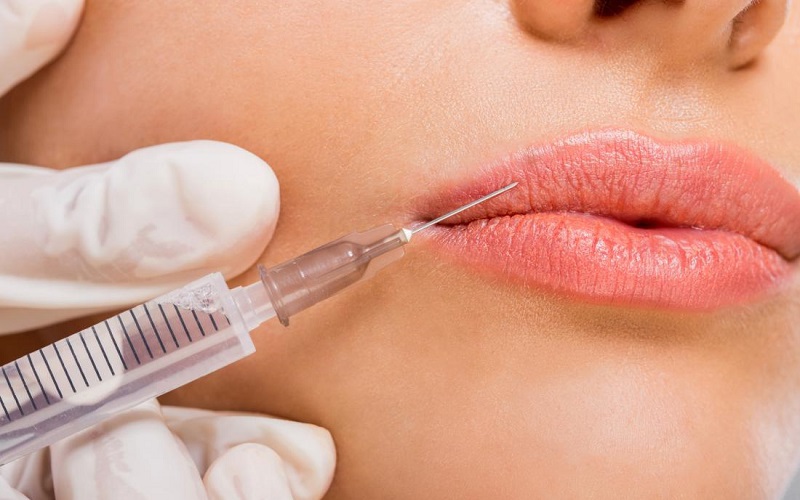 4 nguyên nhân dẫn đến biến chứng khi tiêm filler làm đẹp