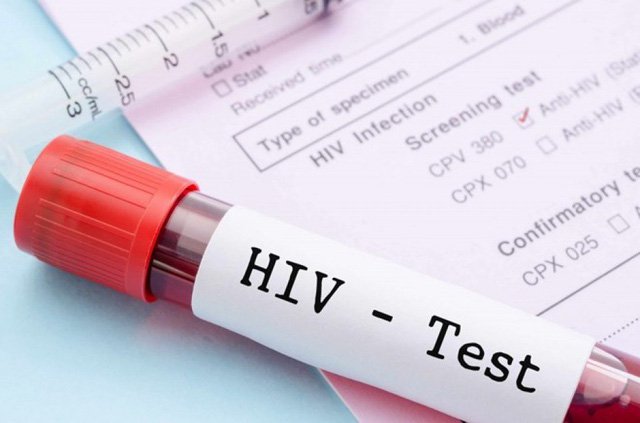 Chia sẻ kinh nghiệm triển khai xét nghiệm nhiễm mới HIV - Ảnh 1.