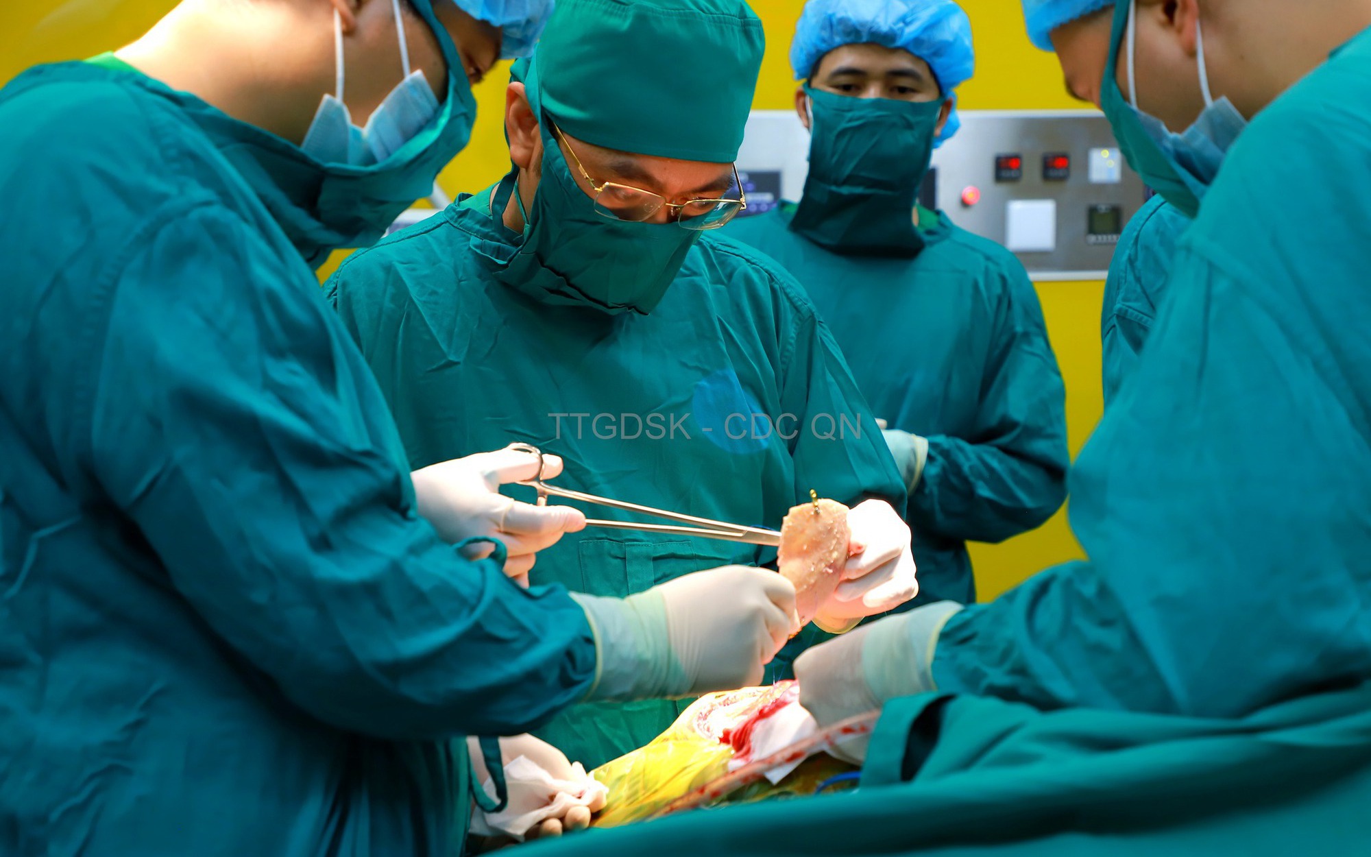 Ca ghép sọ tự thân đầu tiên ở trung tâm y tế tuyến huyện của Quảng Ninh