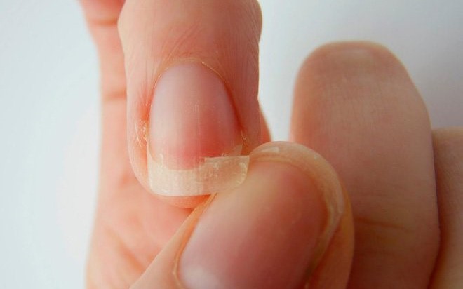 Sơn móng tay nhiều có gây hại không?