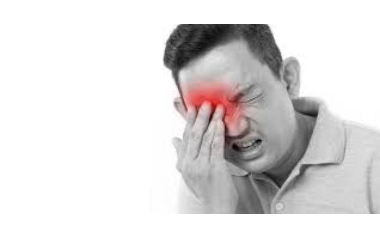 Viêm xoang tái phát mùa mưa bão – Chuyên gia cảnh báo nguyên nhân