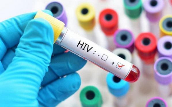 5 lý do để bắt đầu điều trị HIV càng sớm càng tốt