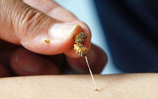 Cao Bằng: Nhiều trường hợp bị ong đốt phải nhập viện cấp cứu