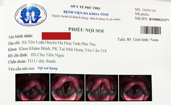 Bị khàn tiếng suốt 2 tháng, đi khám bất ngờ phát hiện ung thư thanh quản - Ảnh 1.