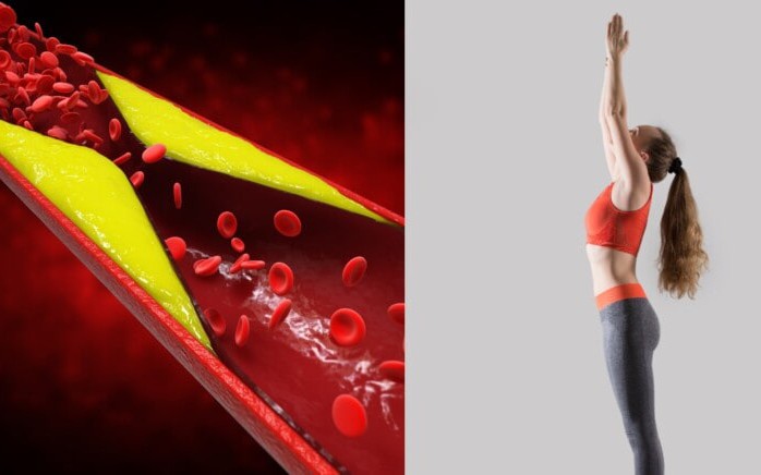 5 cách hỗ trợ kiểm soát cholesterol tự nhiên tại nhà- Ảnh 2.