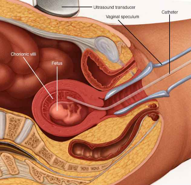Xét nghiệm huyết thống trước sinh có gây nguy hiểm cho thai nhi không? - Ảnh 2.