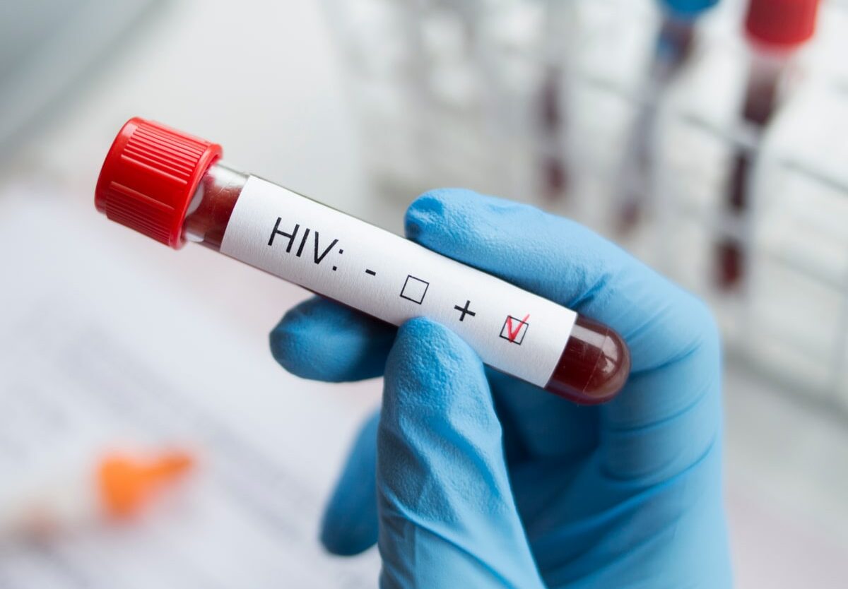 3 lợi ích từ việc xét nghiệm HIV sớm - Ảnh 2.