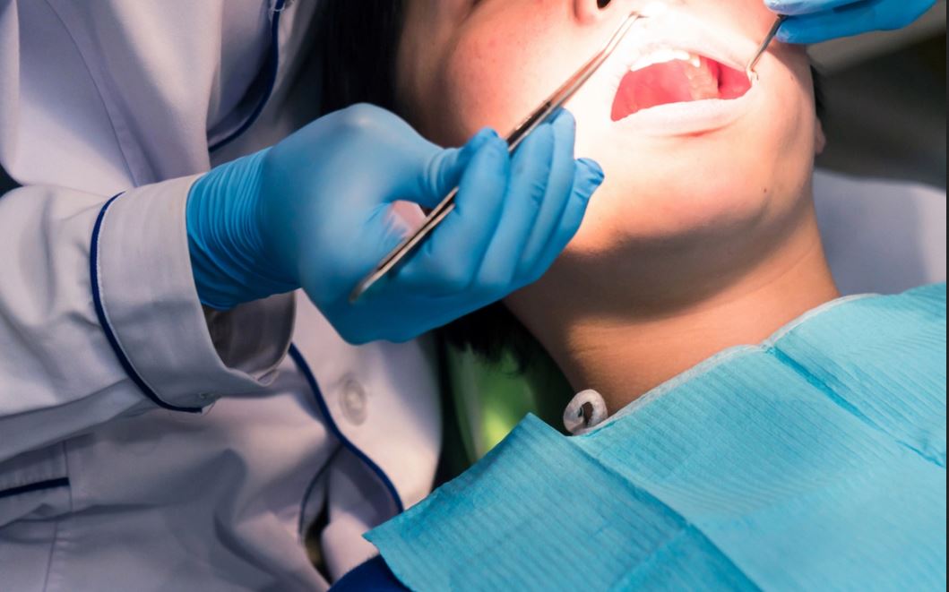 Hút thuốc khiến răng ố vàng, môi thâm mà còn gây ra các bệnh lý về răng miệng nhiều người chưa biết - Ảnh 3.