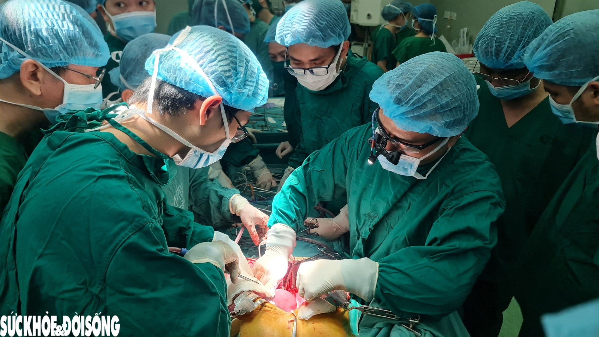 Bệnh viện HNĐK Nghệ An lần đầu tiên thực hiện lấy, ghép tạng từ người cho chết não - Ảnh 2.