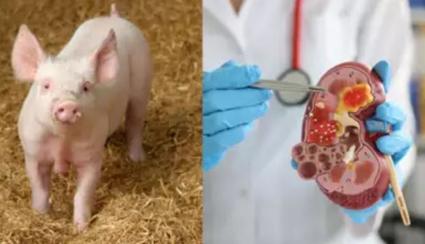 Những bước tiến trong nuôi cấy thận trên phôi lợn để ghép cho người - Ảnh 3.
