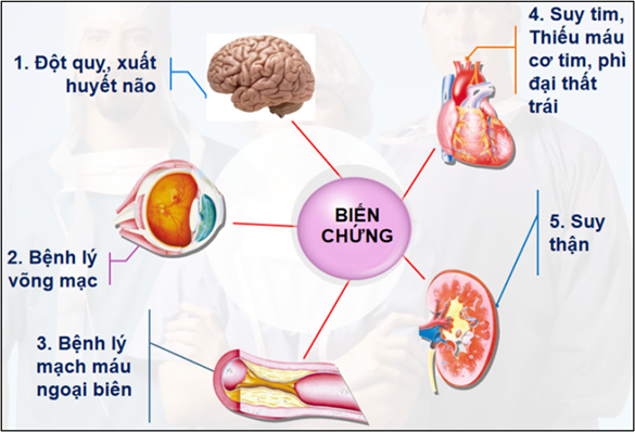 Duy trì hoạt động thể chất giúp giảm huyết áp cao- Ảnh 1.