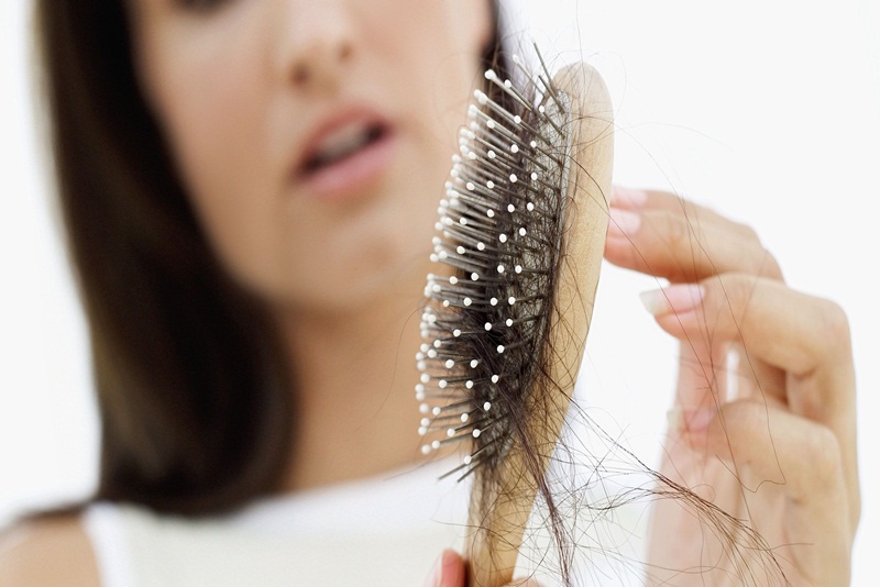 Cách khắc phục rụng tóc ở phụ nữ- Ảnh 1.