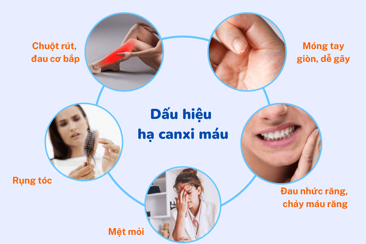 Hạ Canxi Máu Triệu Chứng: Nhận Biết Sớm Để Phòng Ngừa Hiệu Quả