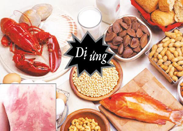 Bệnh Celiac nguy hiểm như thế nào?- Ảnh 2. Bệnh Celiac nguy hiểm như thế nào?- Ảnh 2.