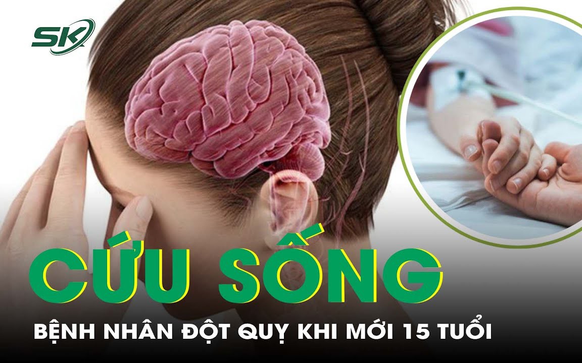 Cứu sống bệnh nhân xuất huyết não, đột quỵ khi mới 15 tuổi