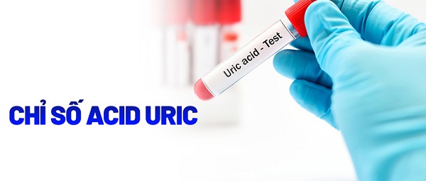 Acid uric bao nhiêu là mắc bệnh gout?- Ảnh 1.