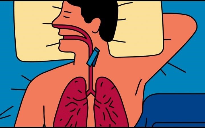 Biểu hiện mắc hội chứng ngưng thở khi ngủ