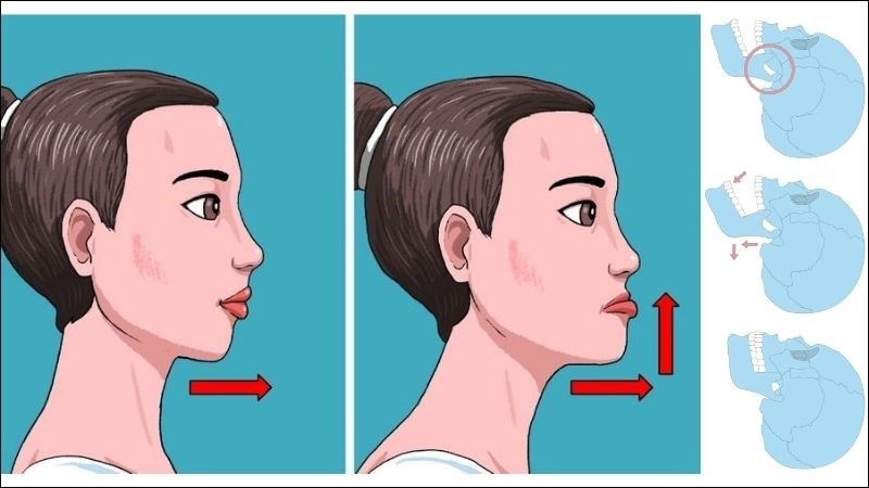 Tập luyện giúp phòng ngừa, hỗ trợ điều trị mòn răng- Ảnh 6. Tập luyện giúp phòng ngừa, hỗ trợ điều trị mòn răng- Ảnh 6.