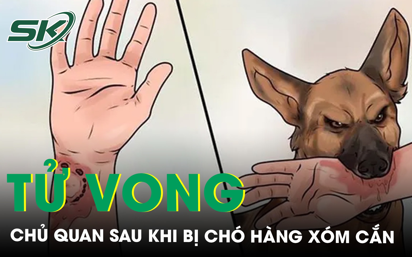 Tử vong do chủ quan sau khi bị chó hàng xóm cắn