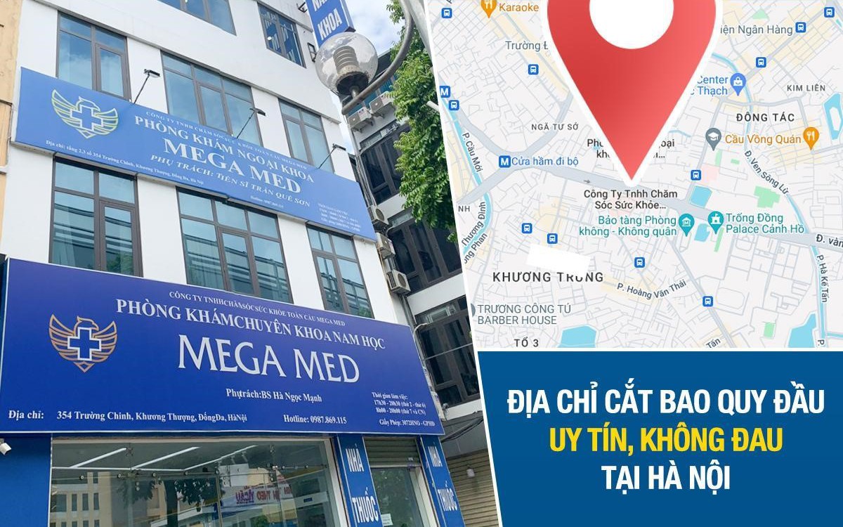 Địa chỉ cắt bao quy đầu uy tín, không đau tại Hà Nội