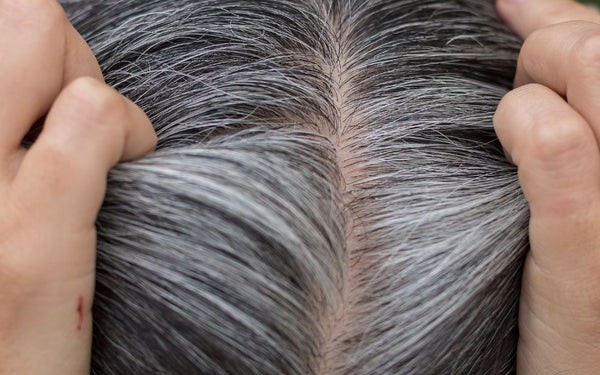 5 loại thực phẩm giúp ngăn ngừa tóc bạc sớm- Ảnh 1. Nguyên nhân khiến tóc bạc sớm và cách khắc phục