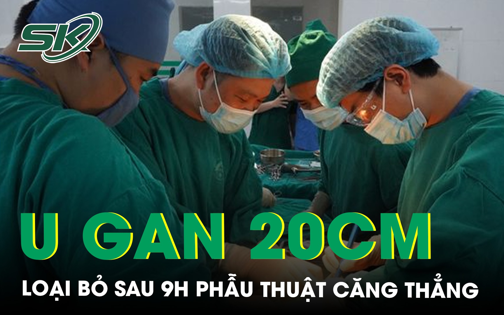 Những loại u gan lành tính thường gặp - Ảnh 2.