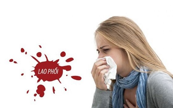 Vì sao tỉ lệ tái nhiễm lao ở người đồng nhiễm lao/HIV lại cao?