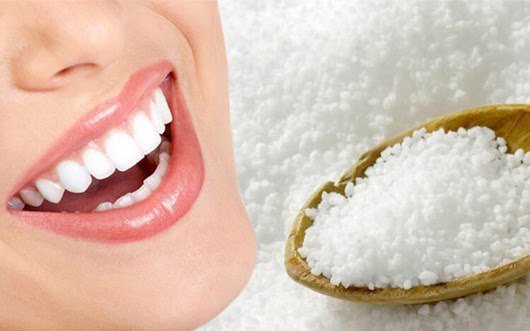 Tẩy trắng răng tại nhà cần ghi nhớ gì, bao lâu có kết quả?