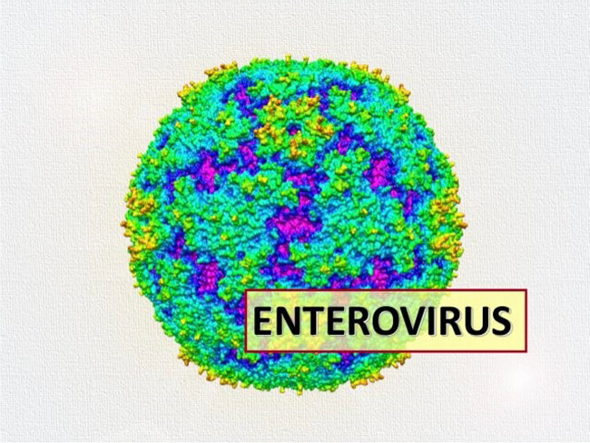 Trẻ sốt, nôn, đau đầu... nhập viện đã viêm màng não do virus- Ảnh 2.