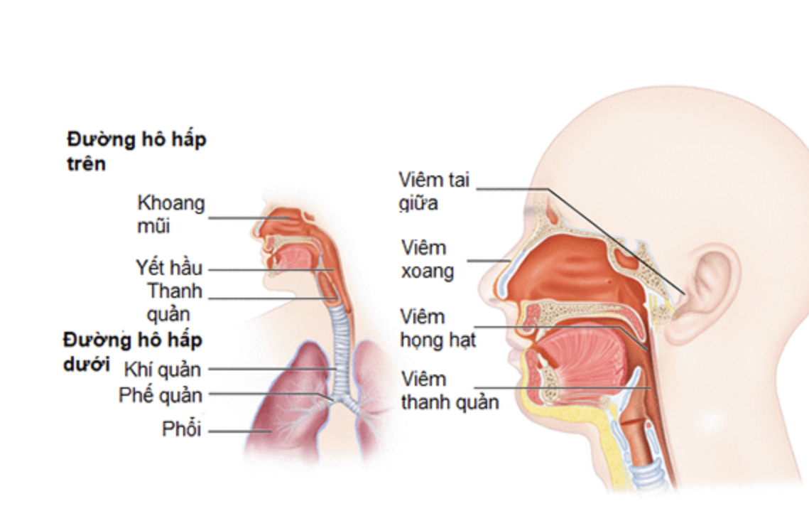 Chế độ ăn cho người bệnh viêm đường hô hấp trên