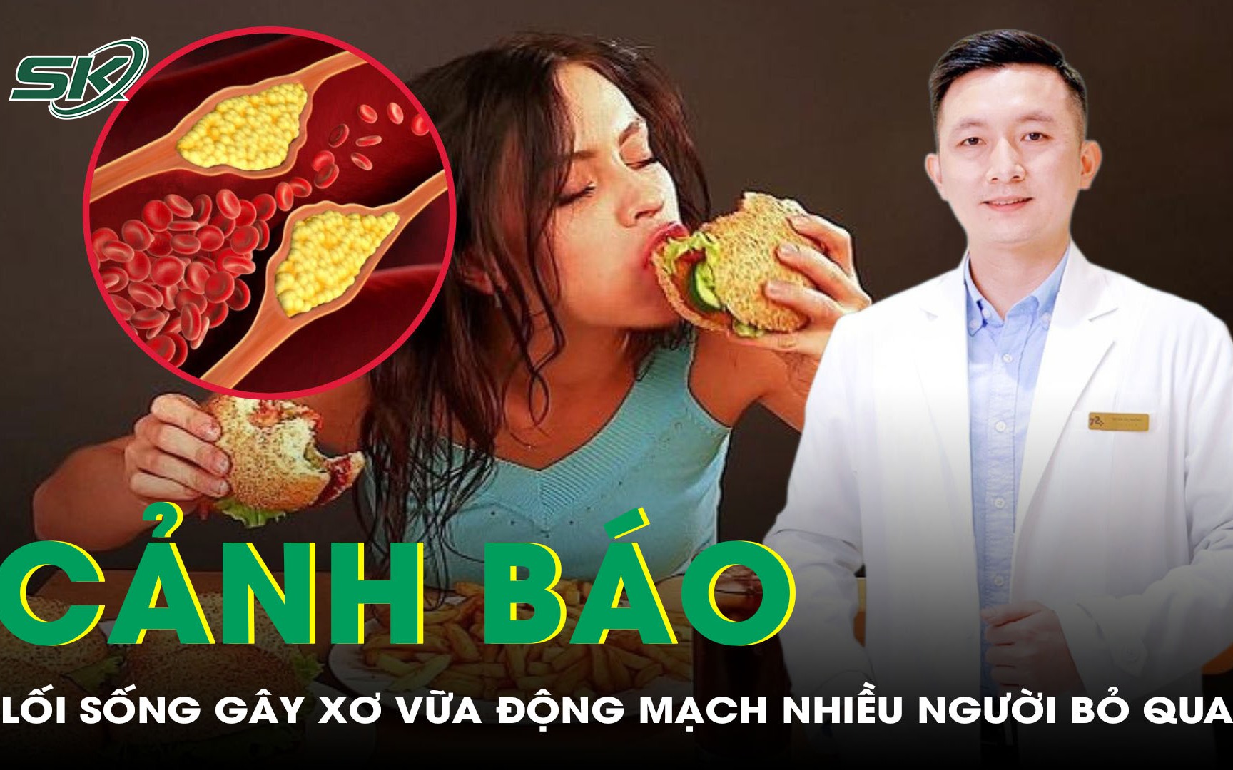 Những lối sống ảnh hưởng nghiêm trọng đến xơ vữa động mạch nhiều người bỏ qua