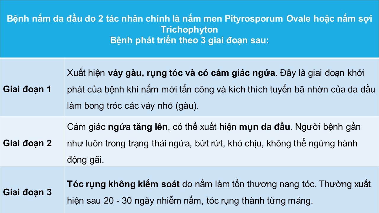 Nấm da đầu là gì? Nguyên nhân & cách cải thiện hiệu quả- Ảnh 1.