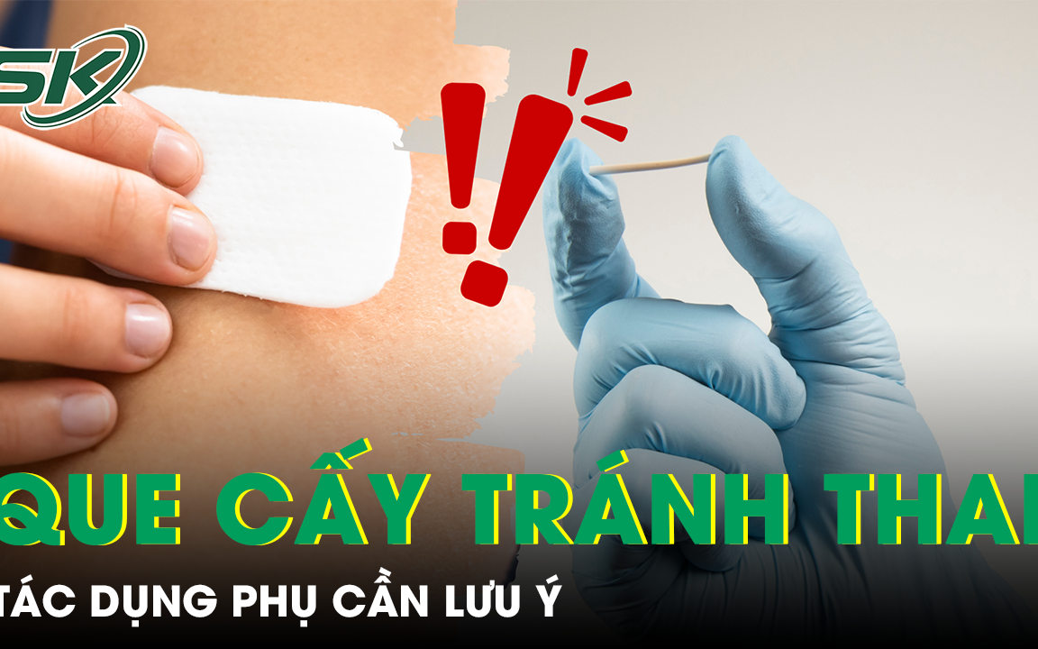 Những tác dụng phụ của que cấy tránh thai cần lưu ý