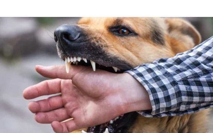Một người tử vong sau gần 2 tháng bị chó cắn