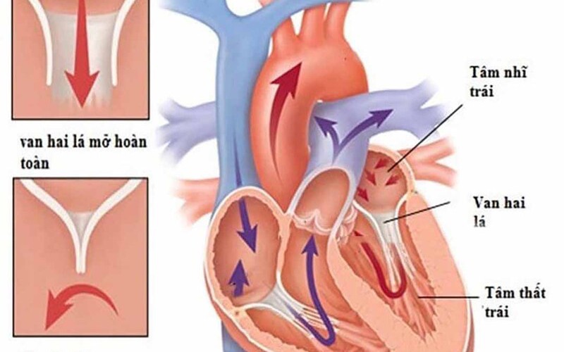 Van hai lá: Nguyên nhân, triệu chứng, phòng bệnh và cách điều trị